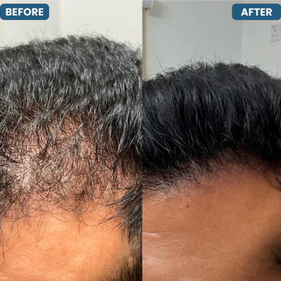 Hair Growth Roll-On Serum