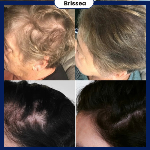 Hair Growth Roll-On Serum