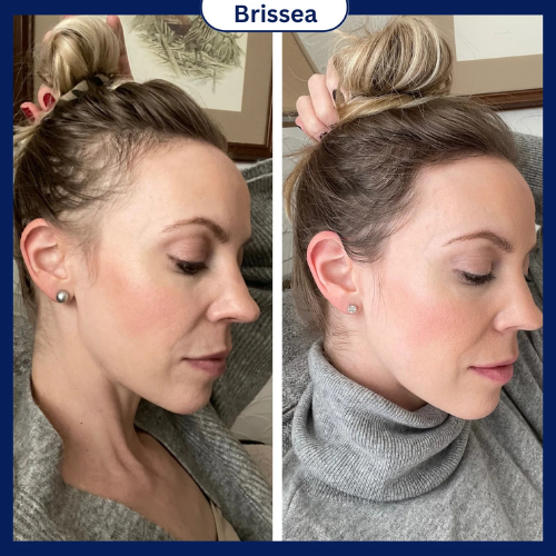 Hair Growth Roll-On Serum