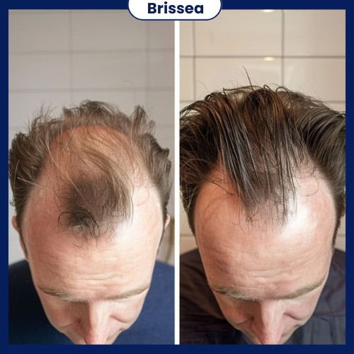 Hair Growth Roll-On Serum