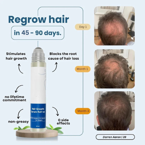 Hair Growth Roll-On Serum