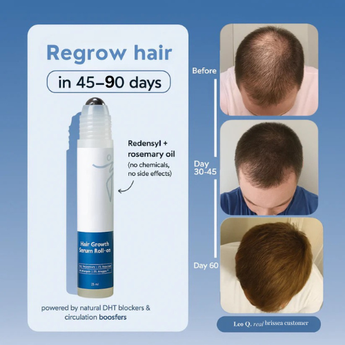 Hair Growth Roll-On Serum
